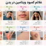 علائم کمبود ویتامین در بدن؛ نشانه‌هایی که نباید نادیده بگیرید