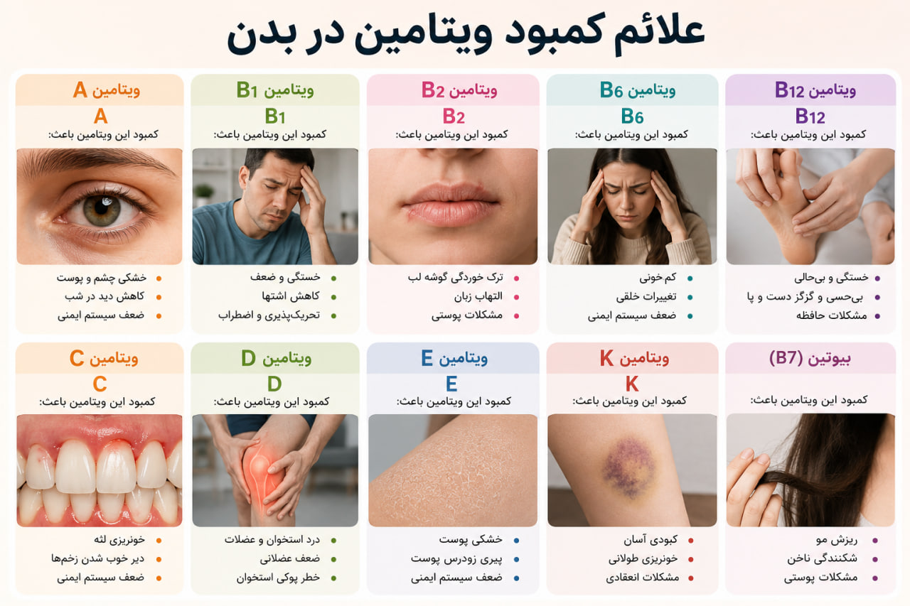 علائم کمبود ویتامین در بدن؛ نشانه‌هایی که نباید نادیده بگیرید