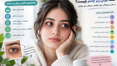 علت تیرگی زیر چشم چیست؟ ۸ علت و راهکار برای کاهش سیاهی دور چشم